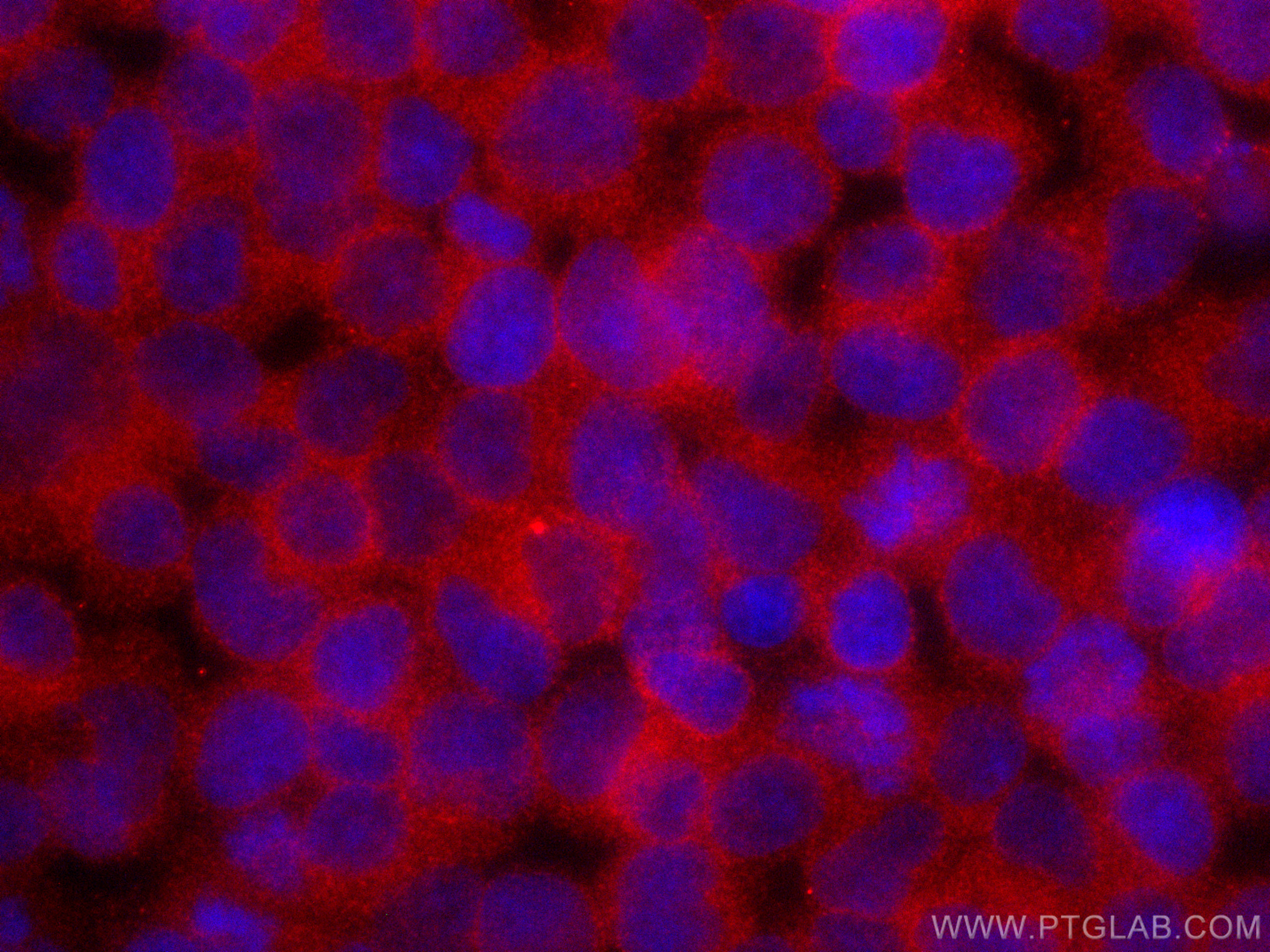 IF Staining of Jurkat using CL594-67067