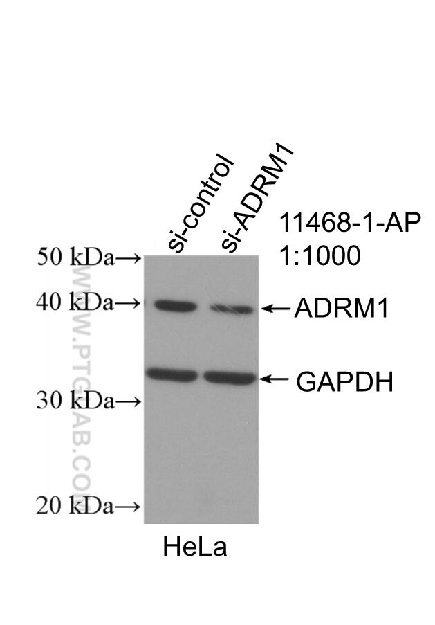 WB analysis of HeLa using 11468-1-AP