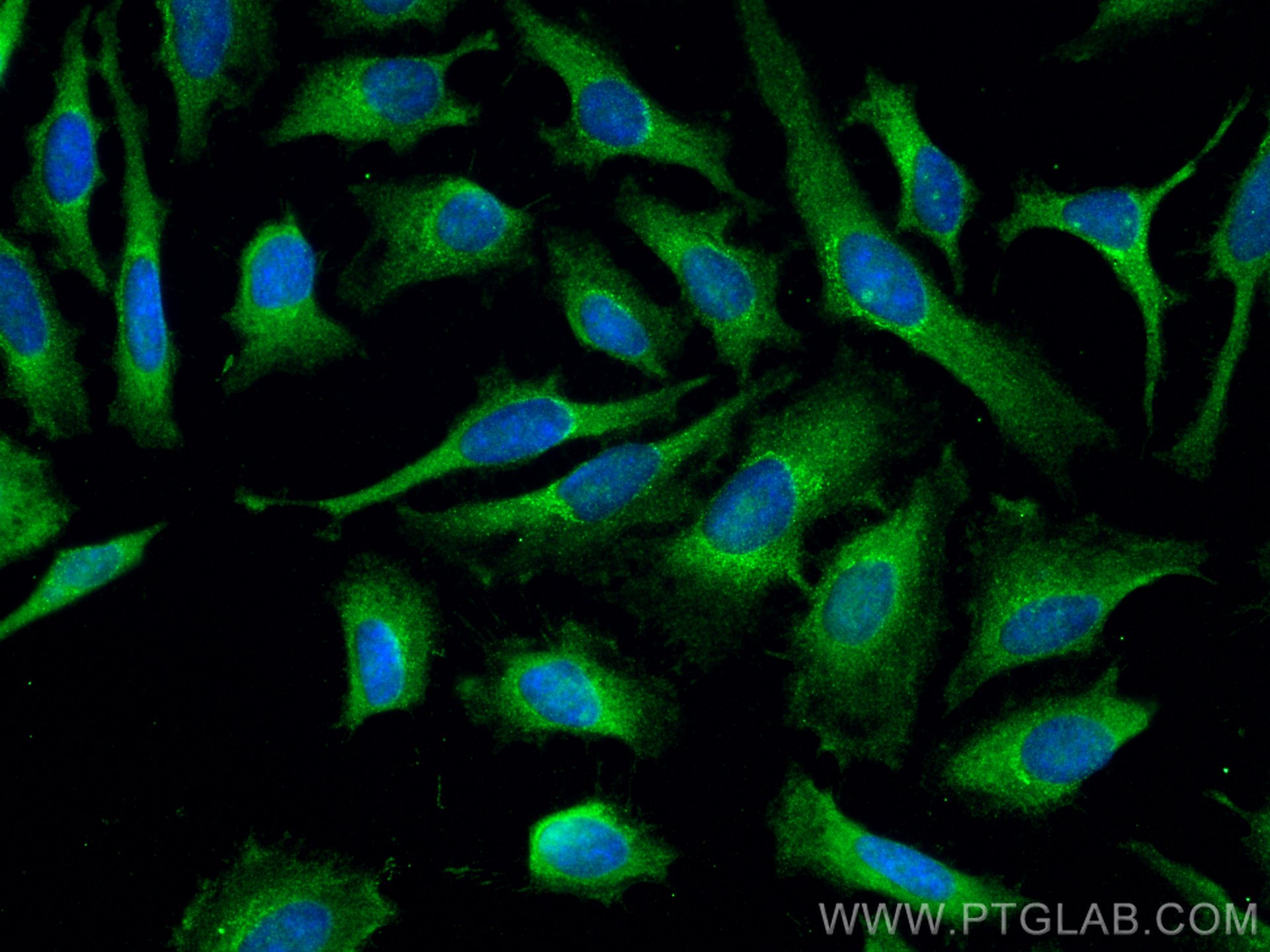 IF Staining of HeLa using 66464-1-Ig (same clone as 66464-1-PBS)