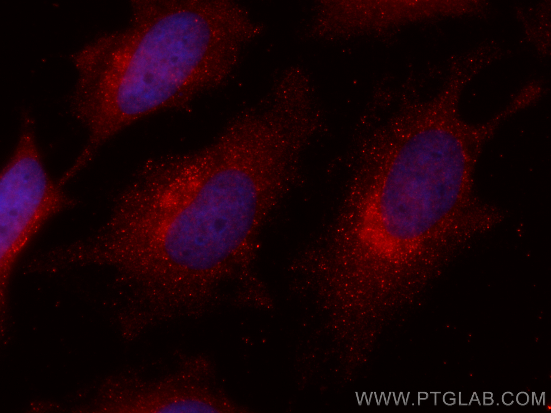 IF Staining of HeLa using CL594-66464