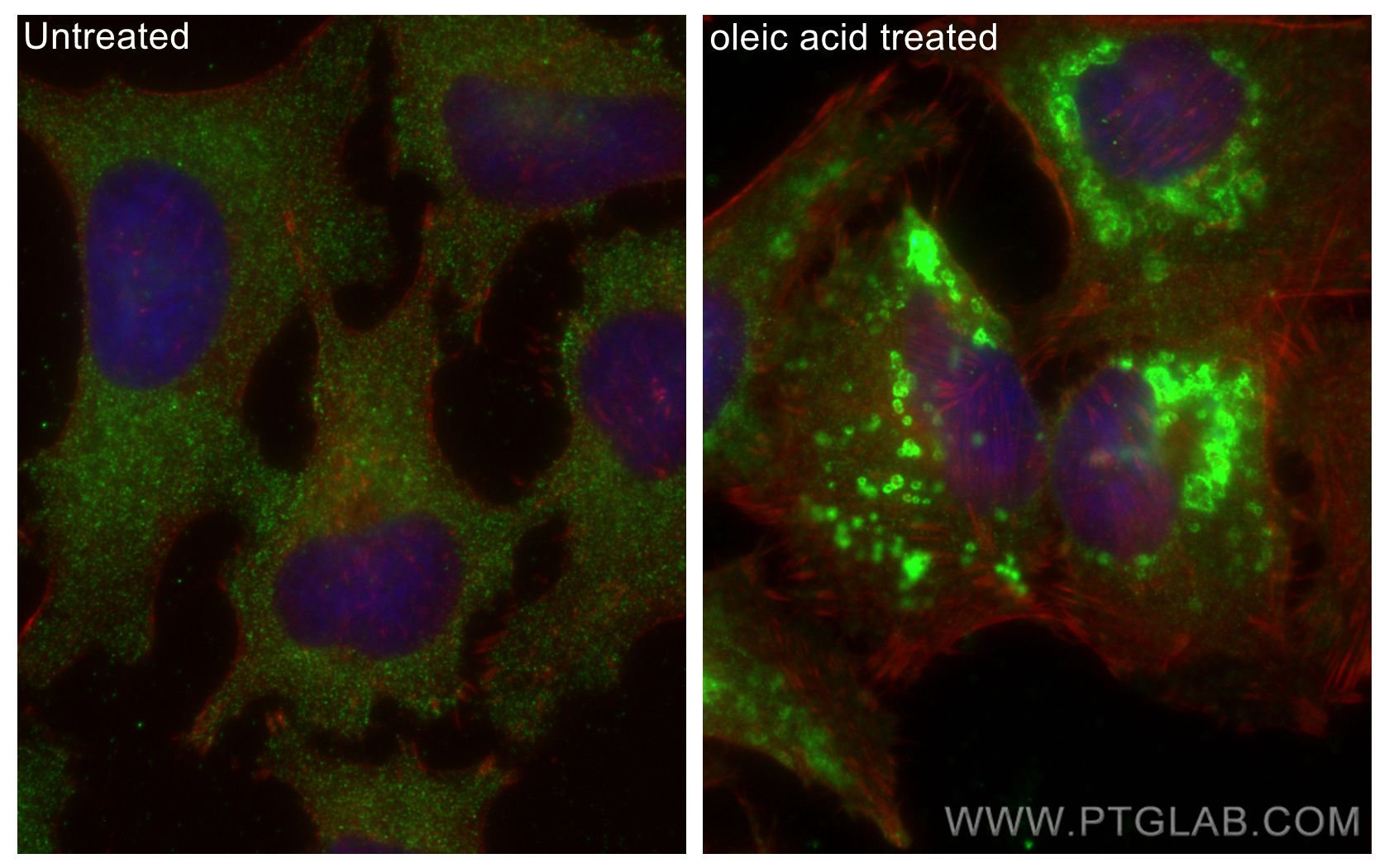 IF Staining of HeLa using 15294-1-AP
