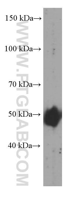 WB analysis of human adipose using 60340-1-Ig