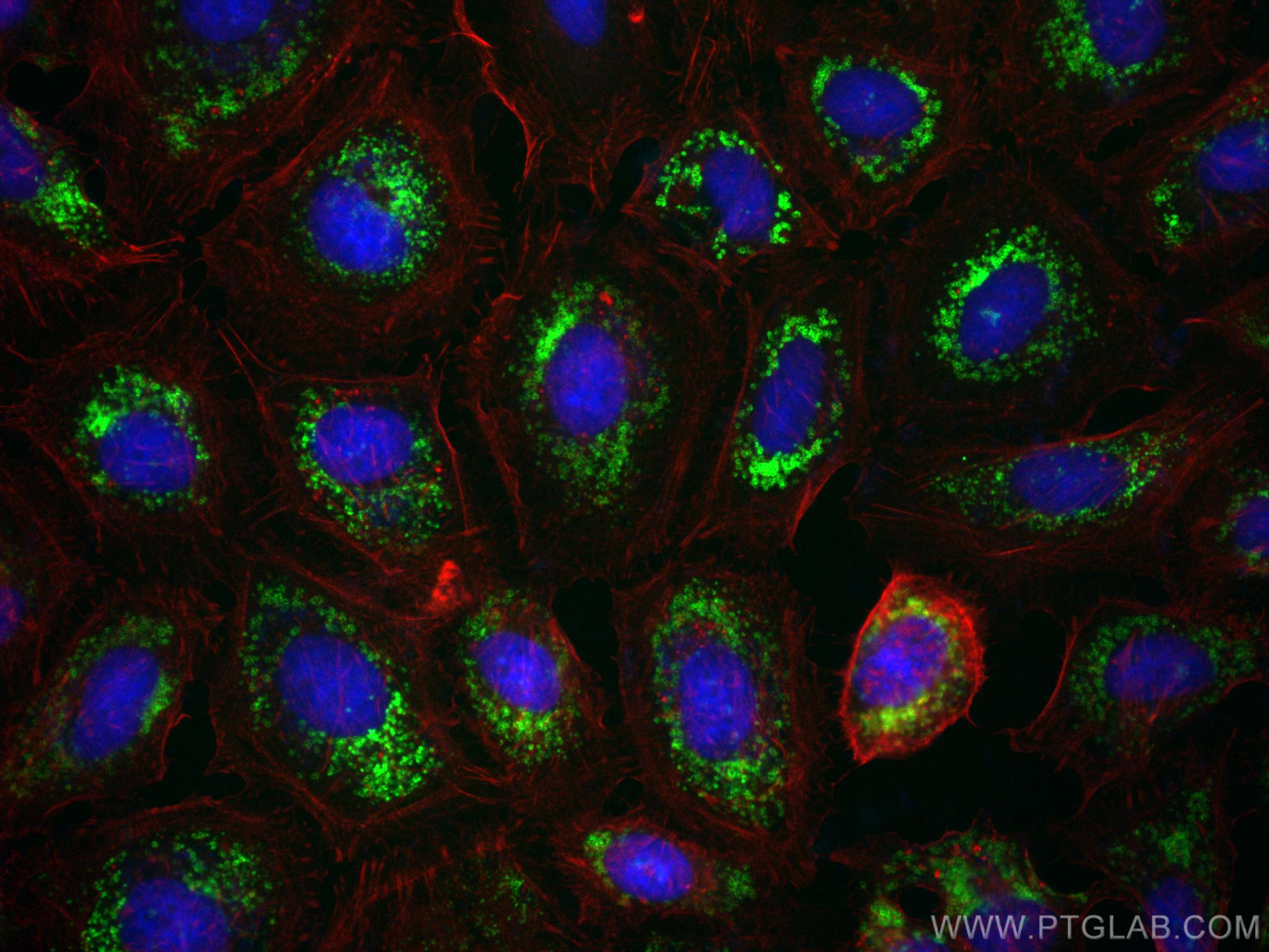 IF Staining of HeLa using 80362-2-RR (same clone as 80362-2-PBS)