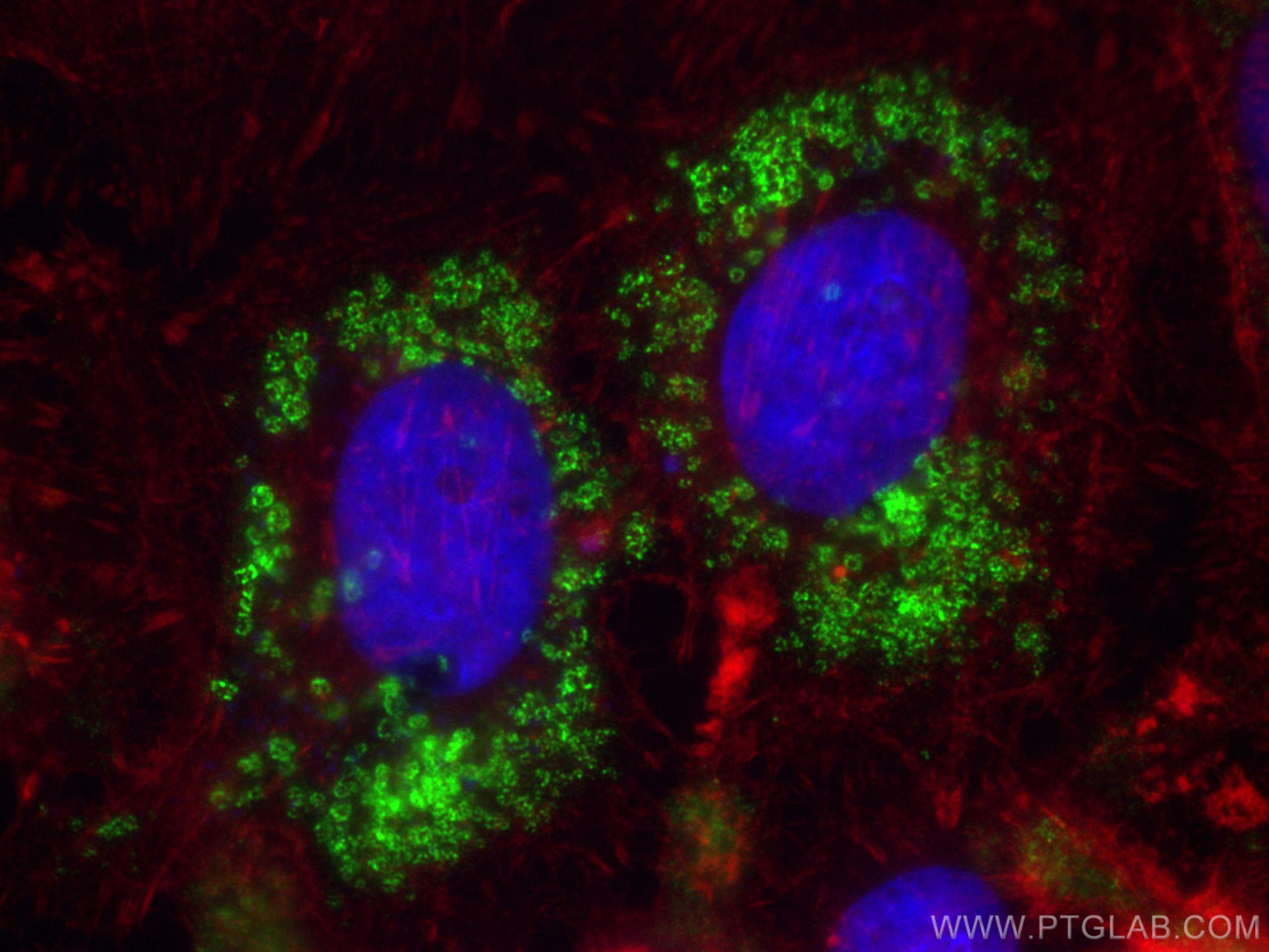 IF Staining of HeLa using 80362-2-RR (same clone as 80362-2-PBS)