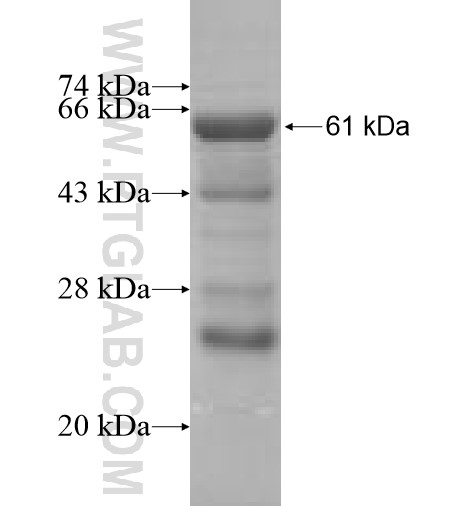 ADSL fusion protein Ag7332 SDS-PAGE