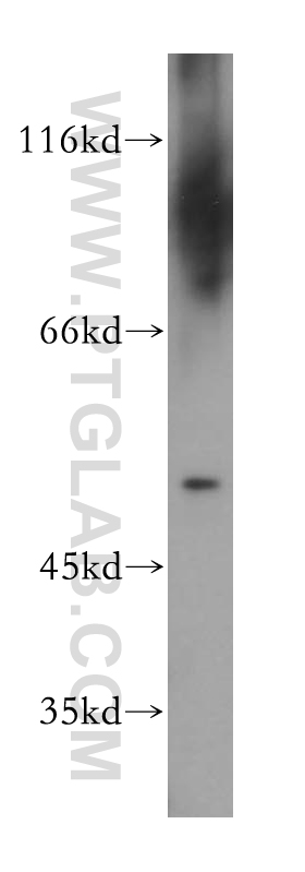 WB analysis of human testis using 11232-2-AP