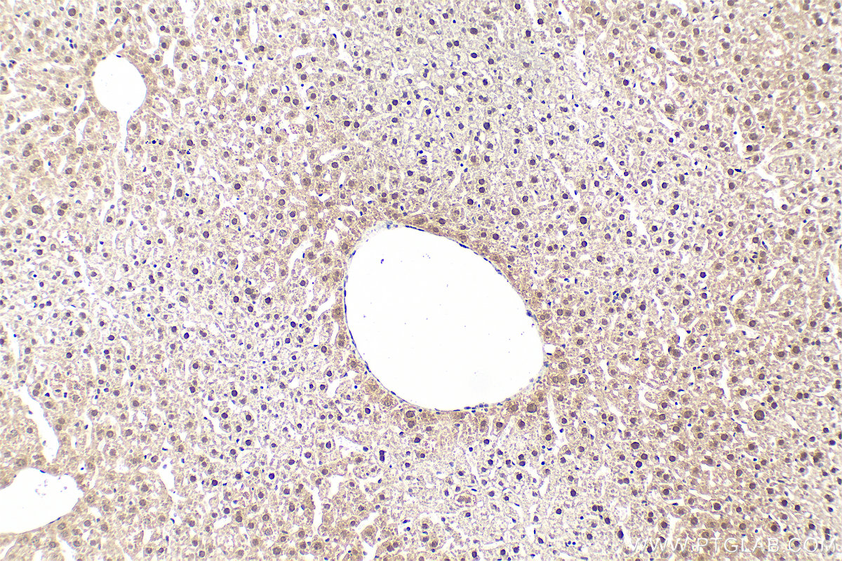 IHC staining of mouse liver using 66141-1-Ig IHC staining of mouse liver using 66141-1-Ig