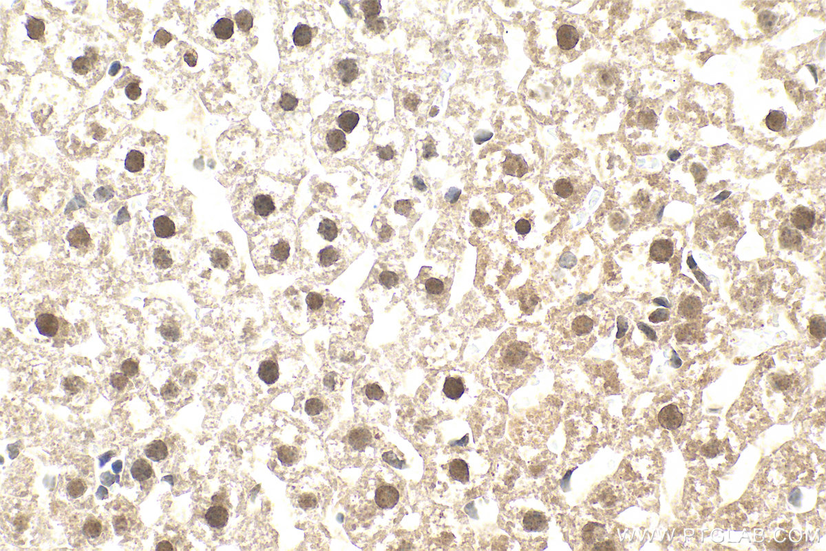 IHC staining of mouse liver using 66141-1-Ig IHC staining of mouse liver using 66141-1-Ig