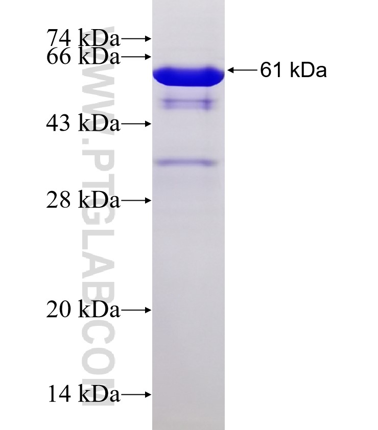 AEBP2 fusion protein Ag1756 SDS-PAGE