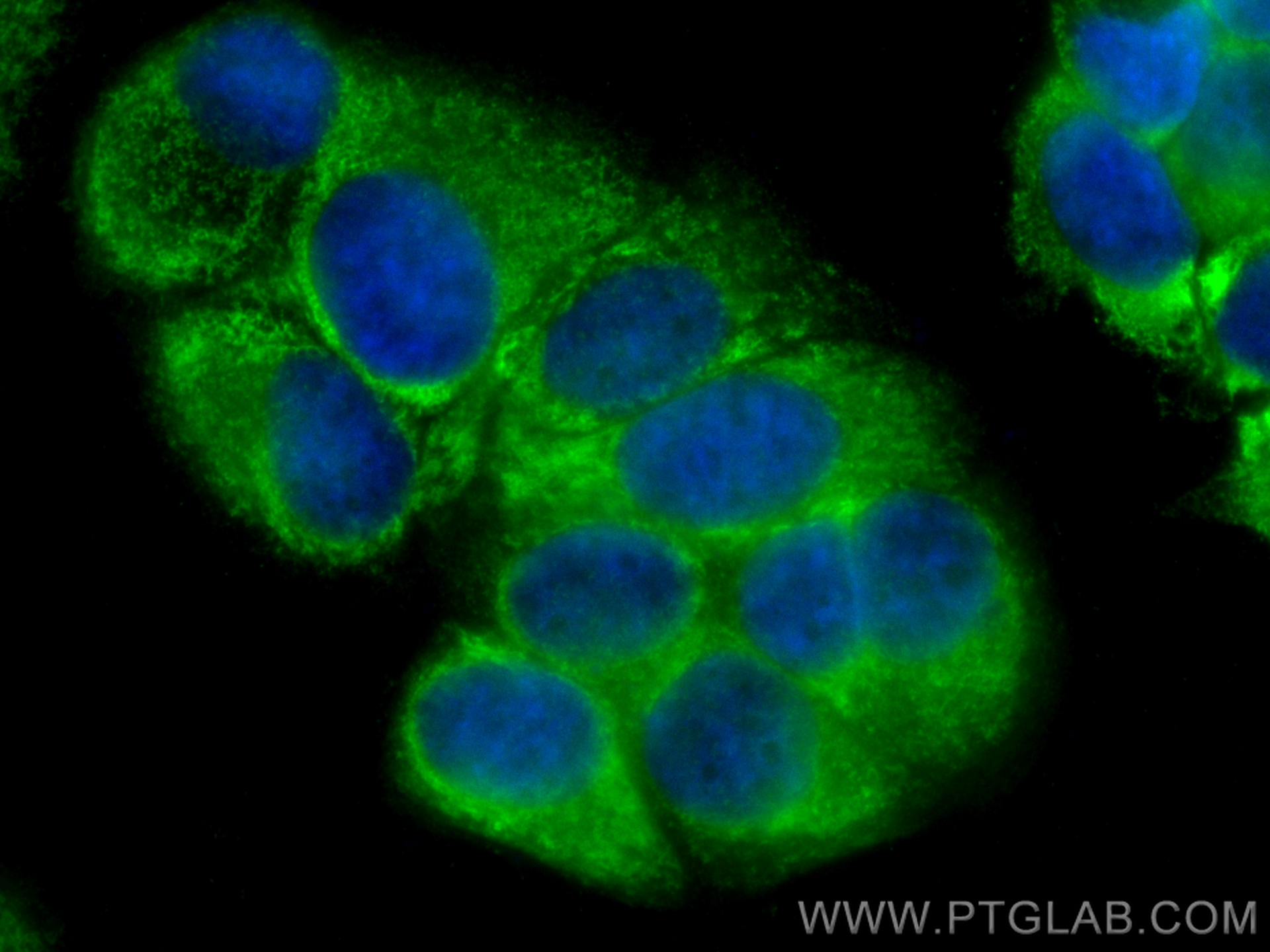 IF Staining of MCF-7 using CL488-13860