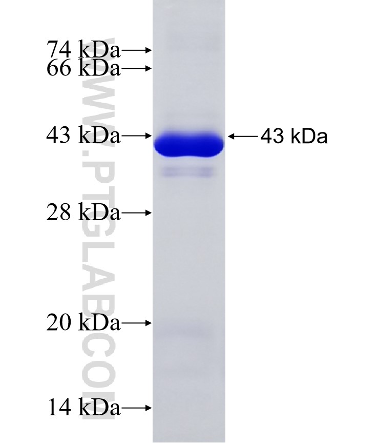 AEN fusion protein Ag34575 SDS-PAGE