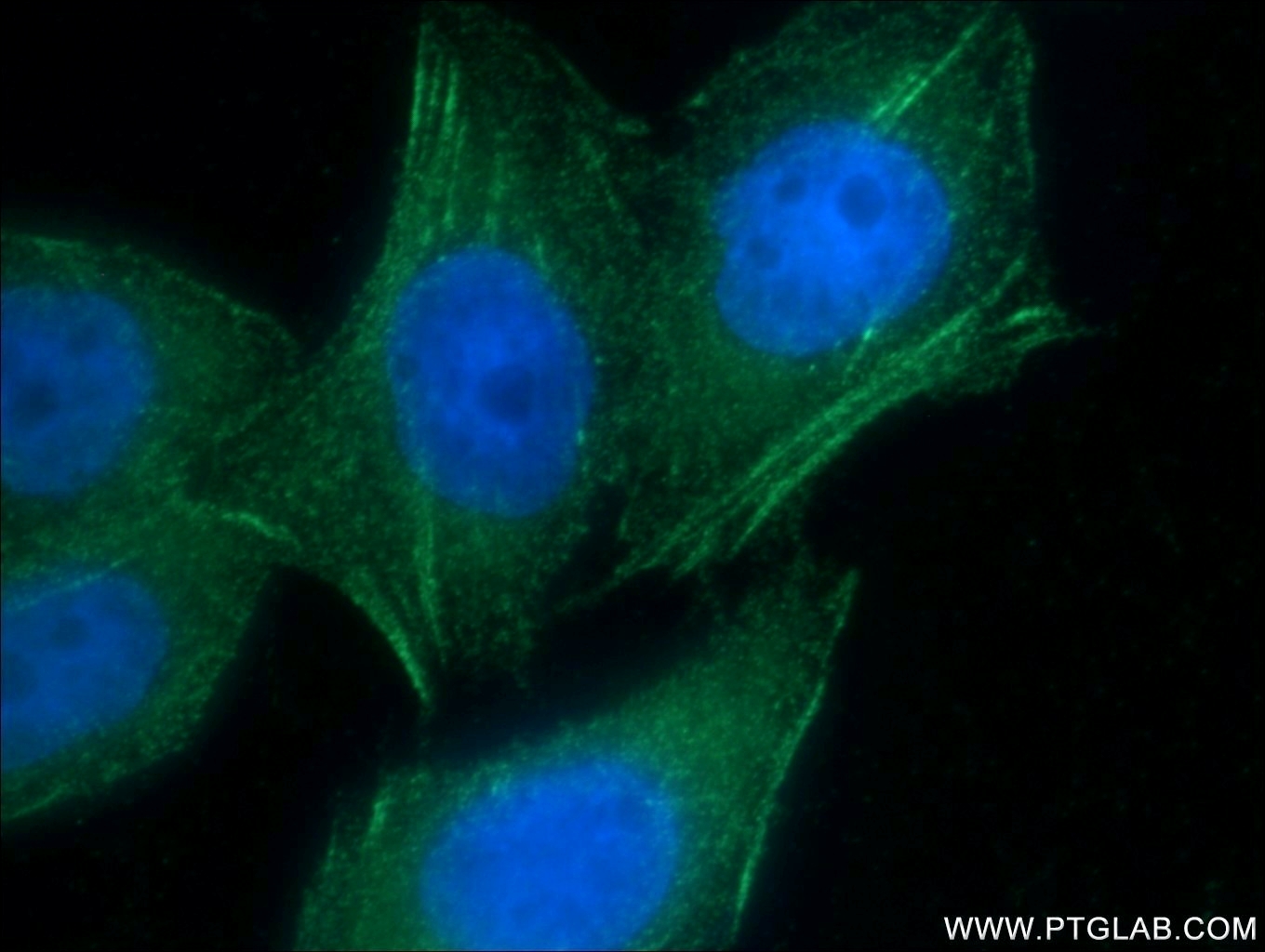 IF Staining of MCF-7 using 21093-1-AP