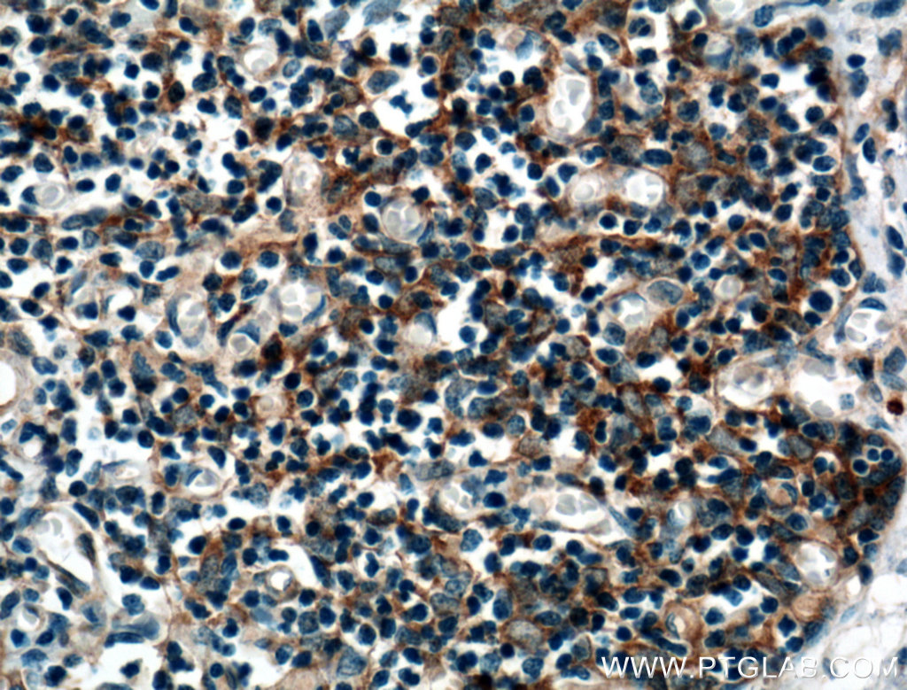 IHC staining of human thymus using 17183-1-AP