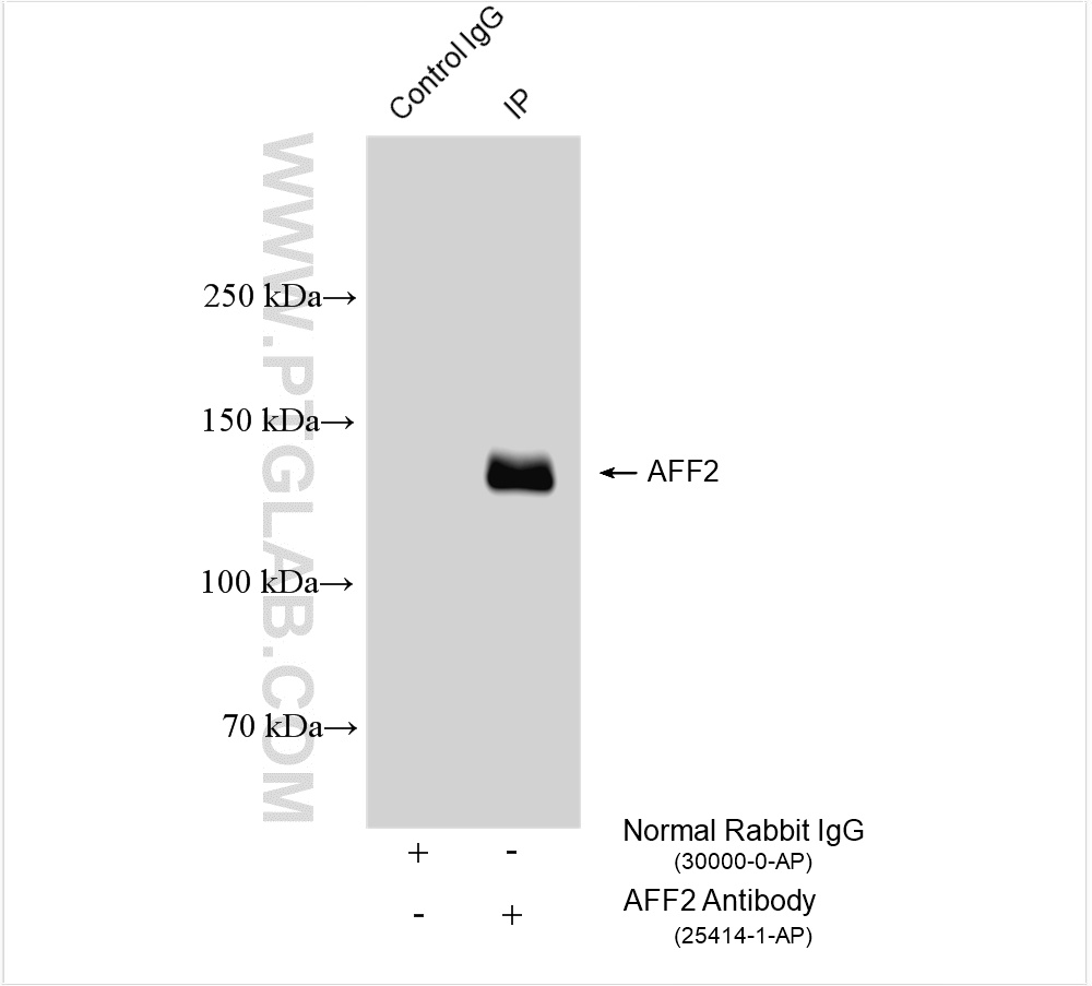IP experiment of SH-SY5Y using 25414-1-AP