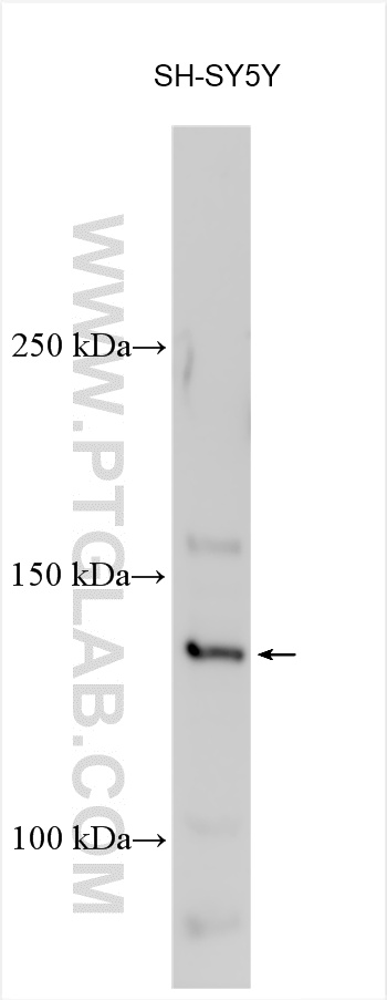 WB analysis using 25414-1-AP