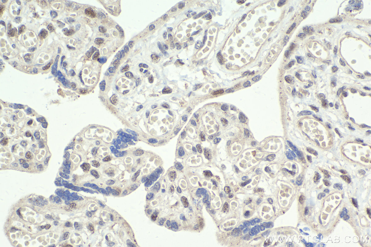 IHC staining of human placenta using 13197-1-AP IHC staining of human placenta using 13197-1-AP
