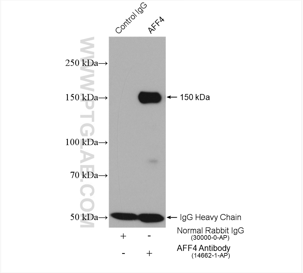 IP experiment of HeLa using 14662-1-AP