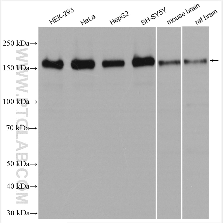 WB analysis using 14662-1-AP