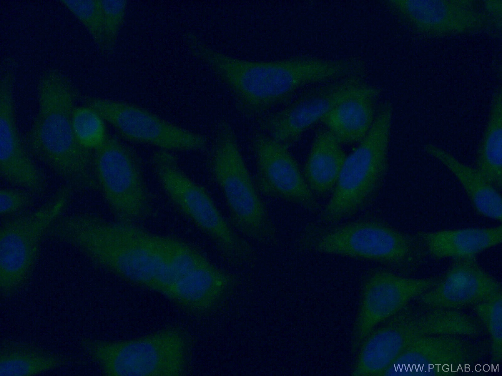 IF Staining of HepG2 using 19494-1-AP