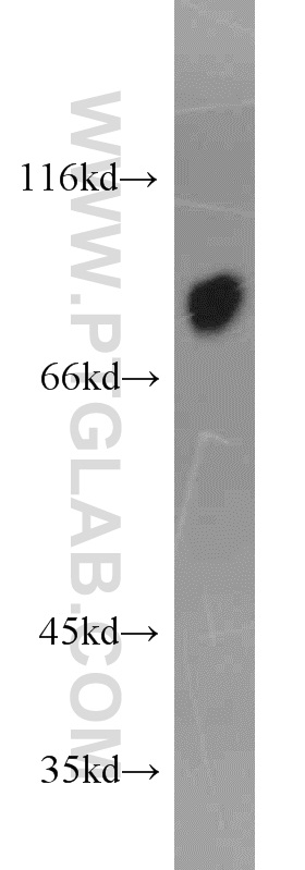 WB analysis of human plasma using 19494-1-AP