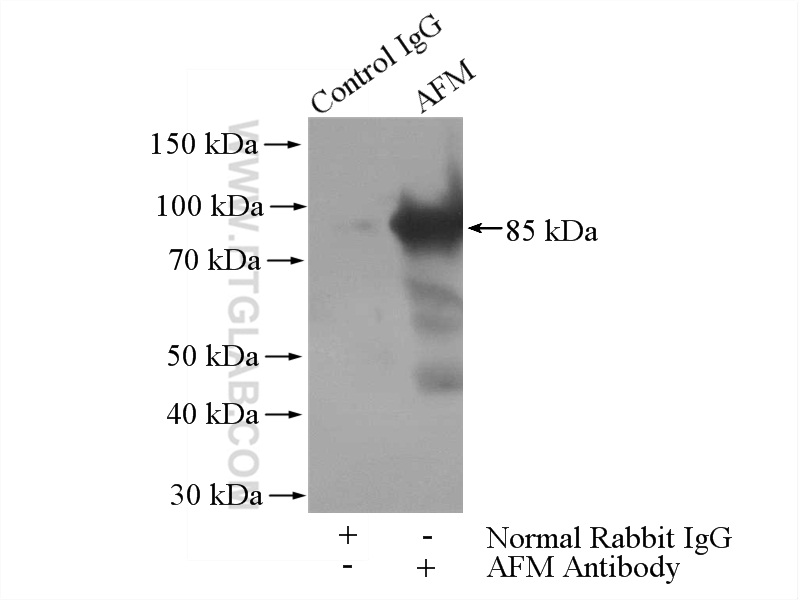 IP experiment of human plasma using 25280-1-AP (same clone as 25280-1-PBS)