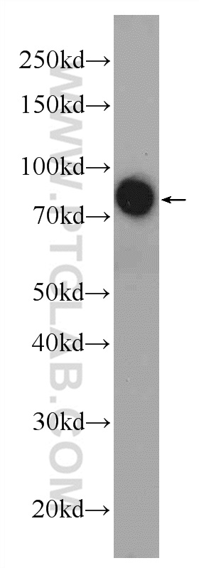 WB analysis of human blood using 25280-1-AP (same clone as 25280-1-PBS)