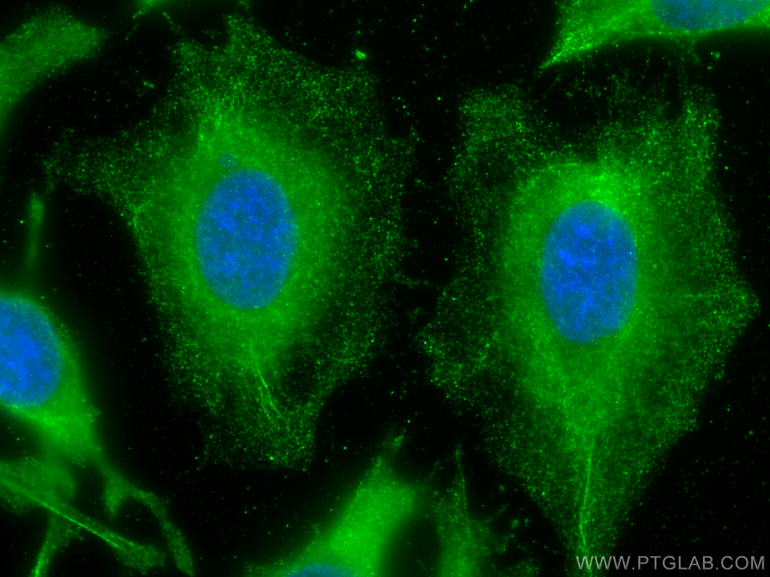 IF Staining of HeLa using 66113-1-Ig (same clone as 66113-1-PBS)