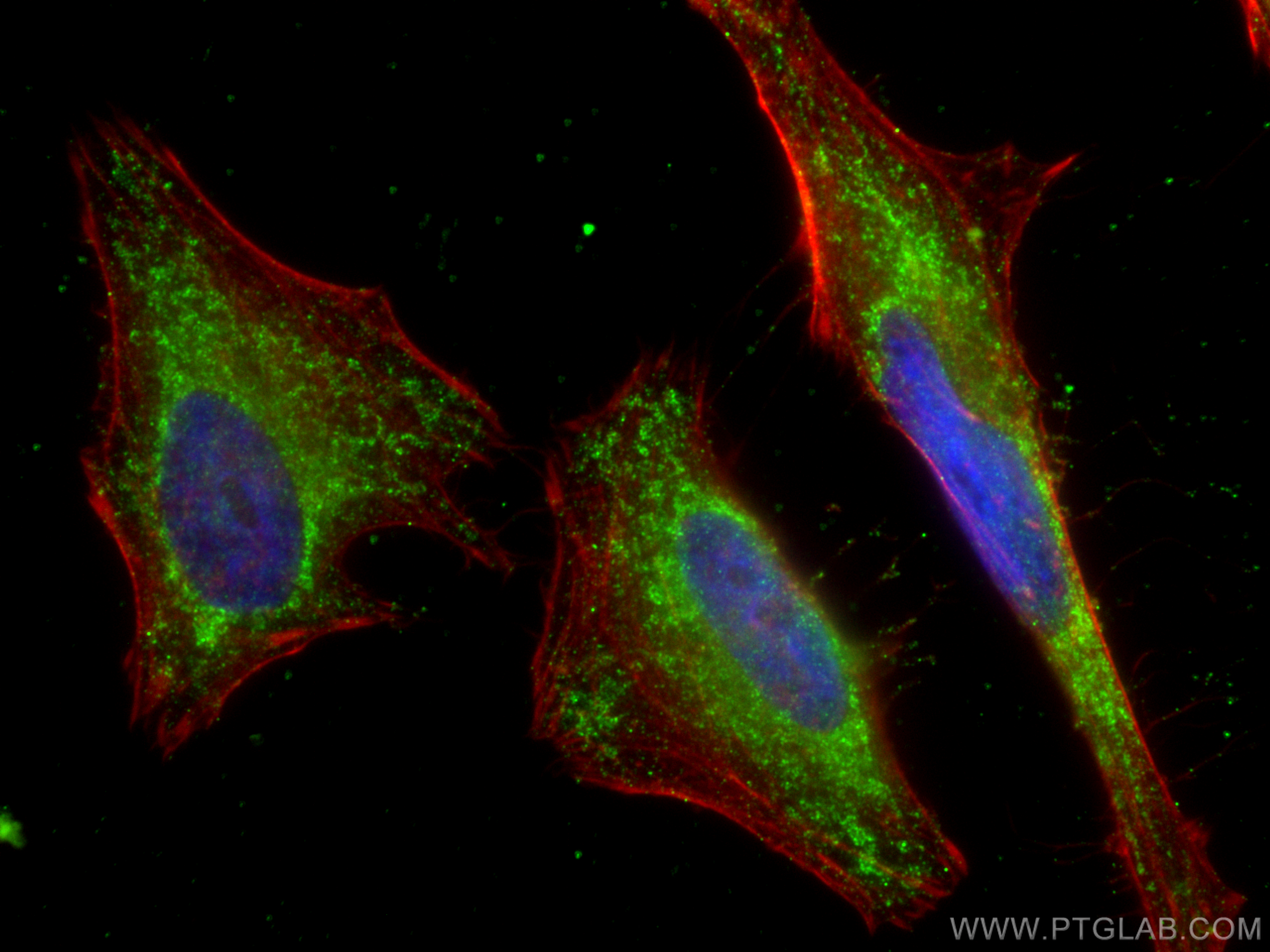 IF Staining of HeLa using 66113-1-Ig (same clone as 66113-1-PBS)