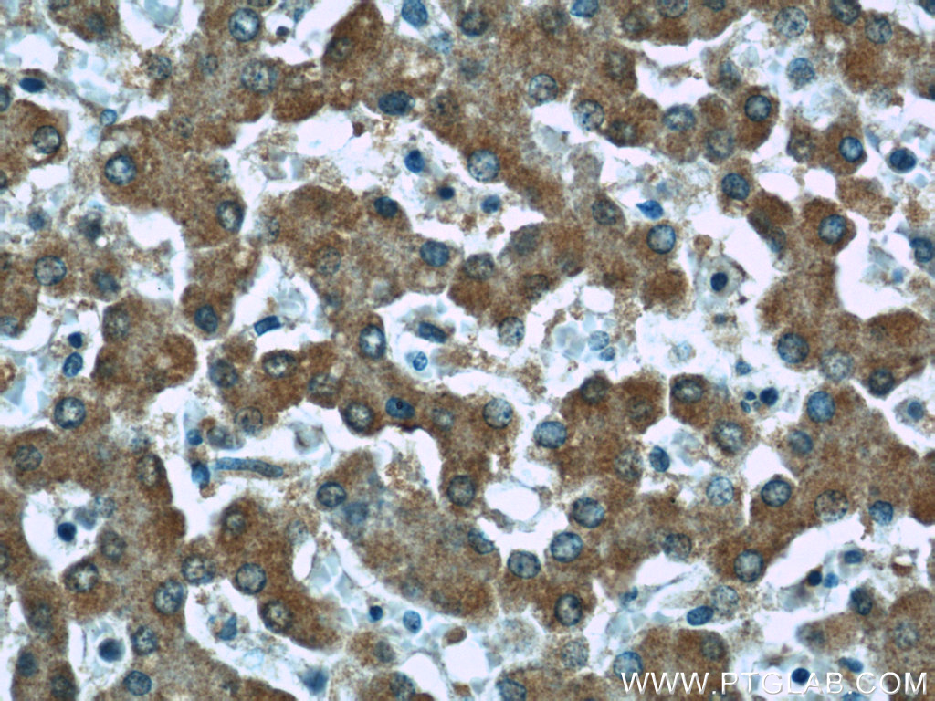 IHC staining of human liver using 66113-1-Ig (same clone as 66113-1-PBS)