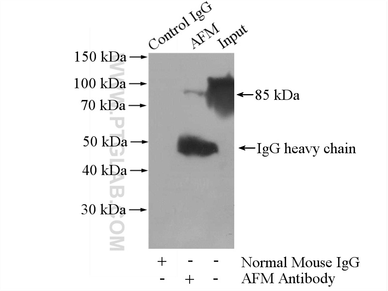 IP experiment of human plasma using 66113-1-Ig (same clone as 66113-1-PBS)