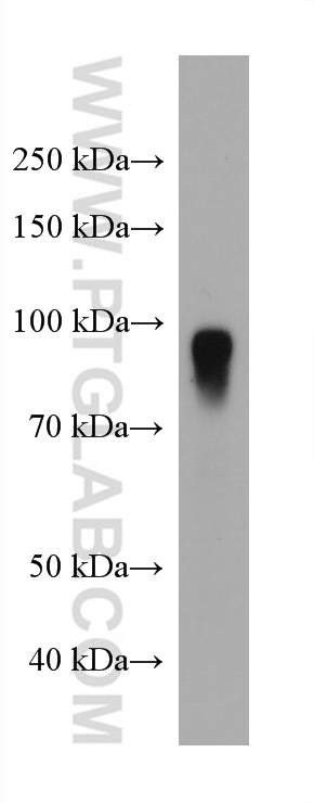 WB analysis of human plasma using 66113-1-Ig