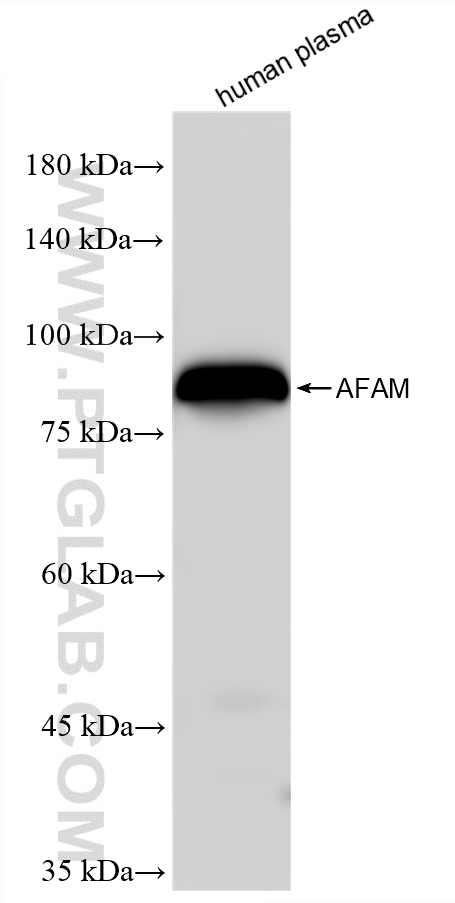 WB analysis of human plasma using 88507-1-RR (same clone as 88507-1-PBS) WB analysis of human plasma using 88507-1-RR (same clone as 88507-1-PBS)