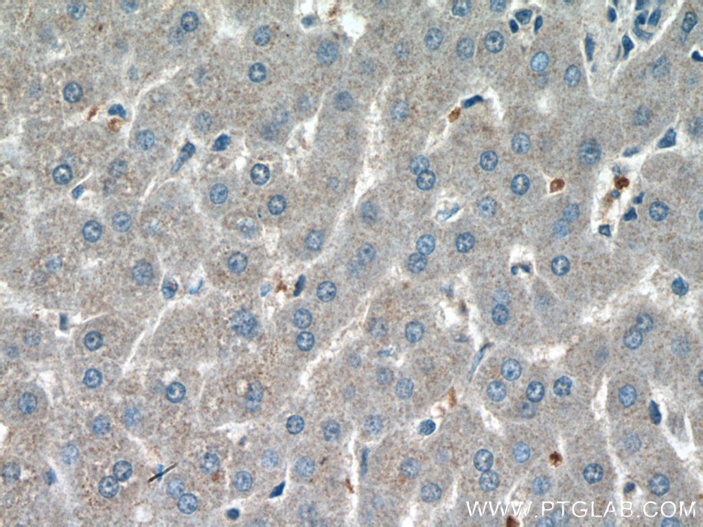 IHC staining of human liver using 19522-1-AP