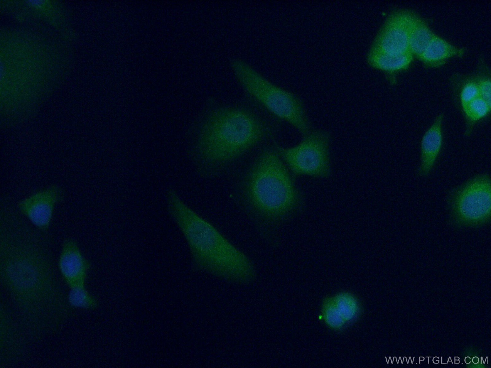 IF Staining of MCF-7 using 14550-1-AP
