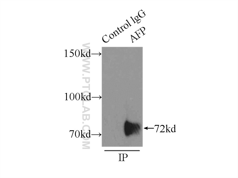 AFP Polyclonal antibody