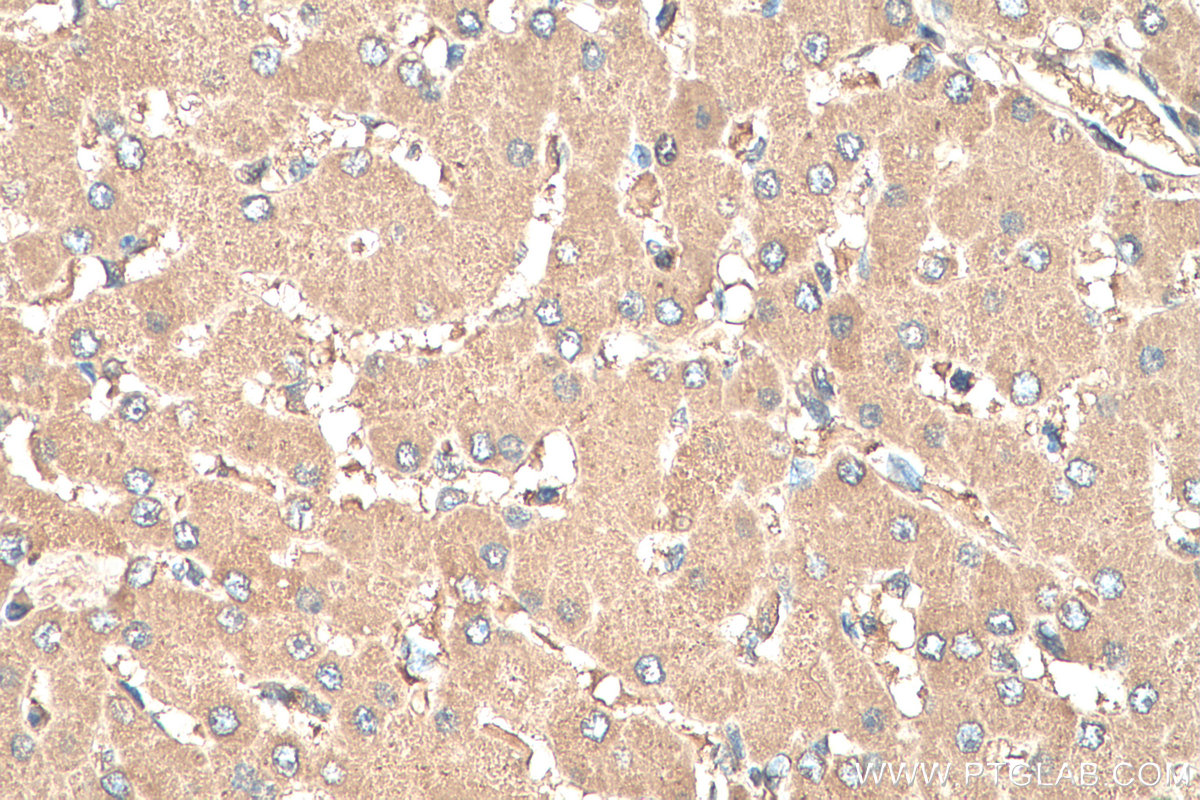 IHC staining of human liver using 67852-1-Ig