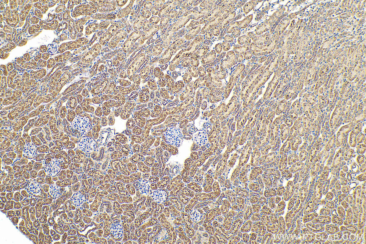 IHC staining of mouse kidney using 17299-1-AP