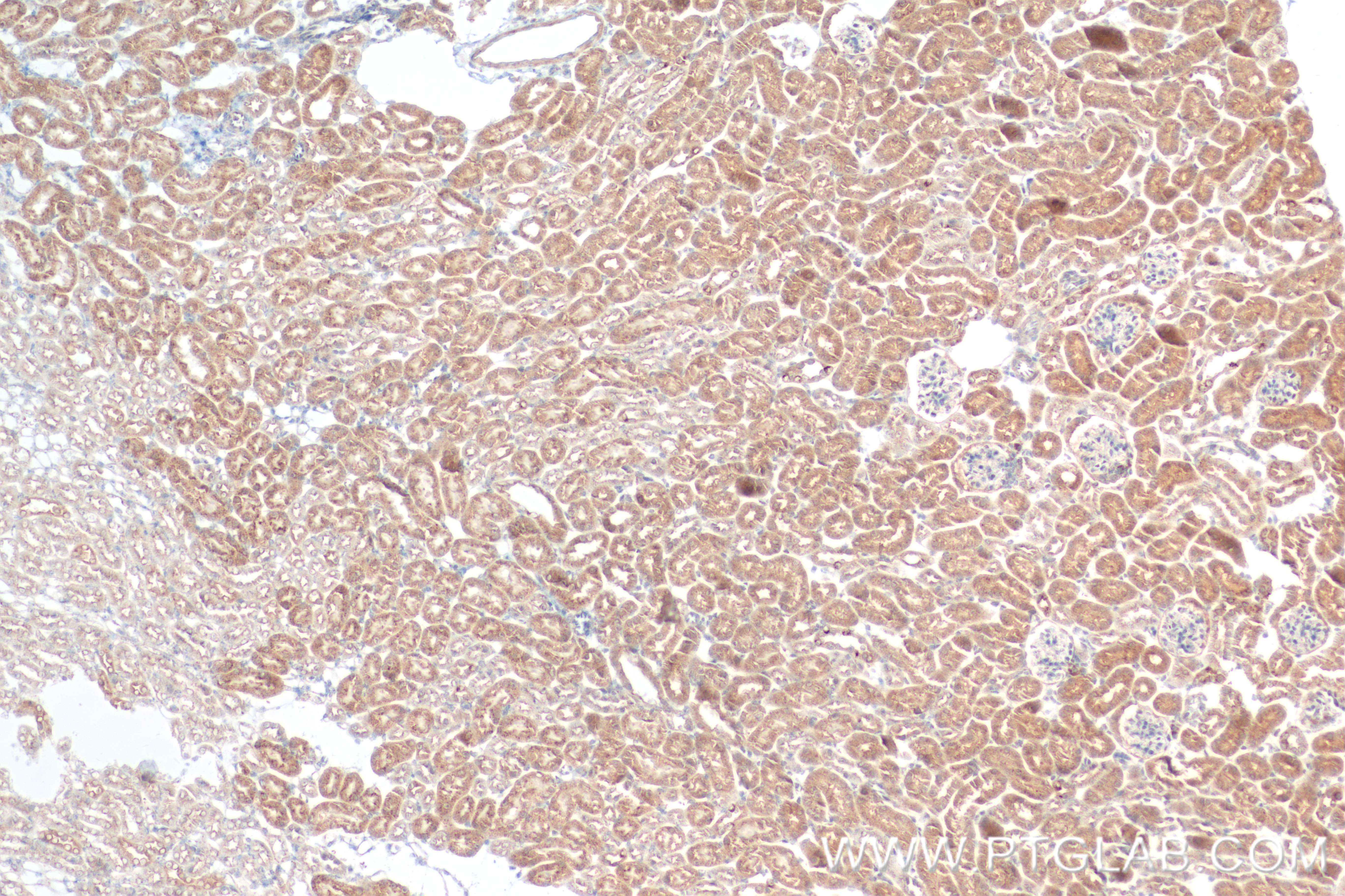 IHC staining of mouse kidney using 83442-6-RR (same clone as 83442-6-PBS)