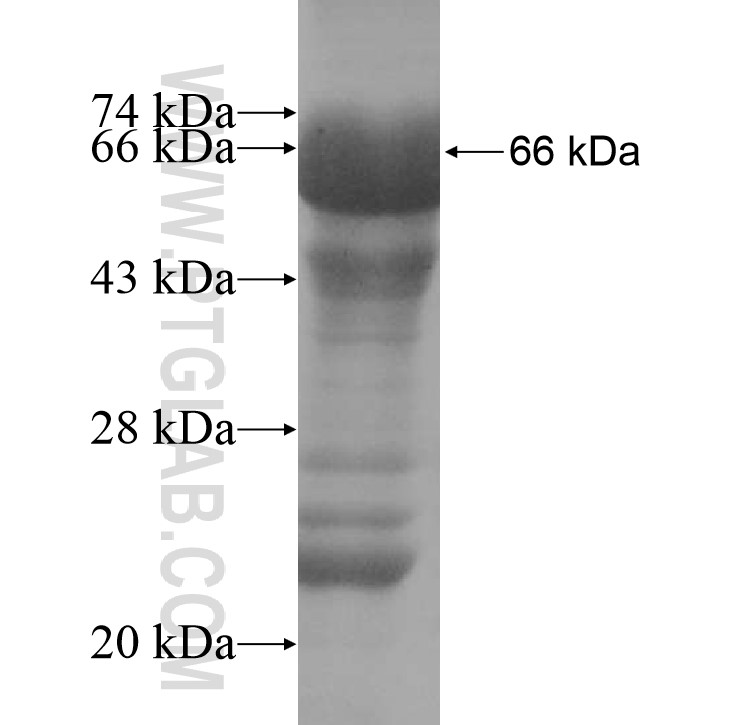 AGA fusion protein Ag10681 SDS-PAGE