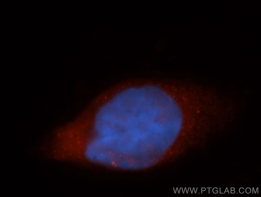 IF Staining of HeLa using 14690-1-AP