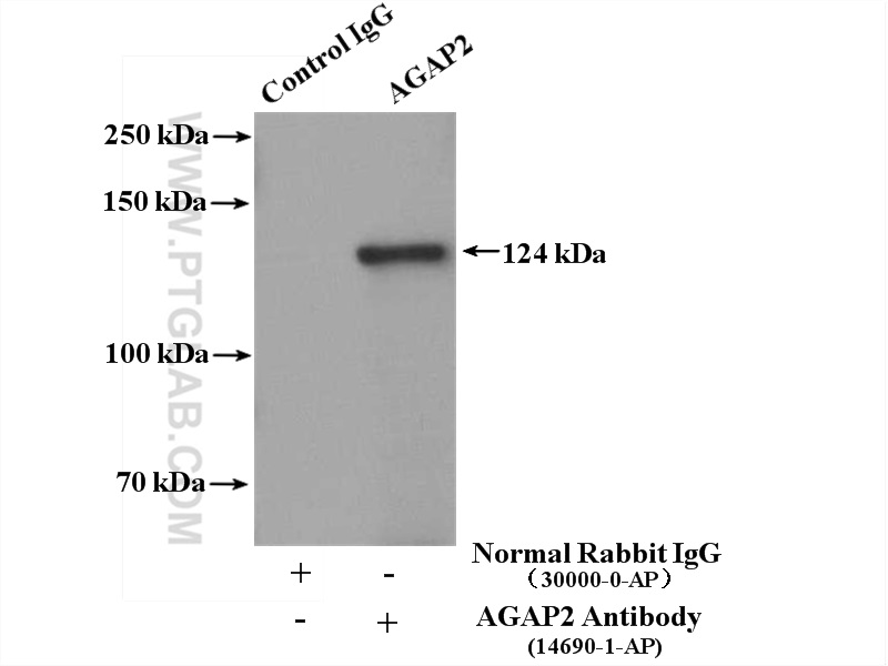 IP experiment of mouse brain using 14690-1-AP