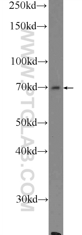 WB analysis of mouse liver using 16990-1-AP