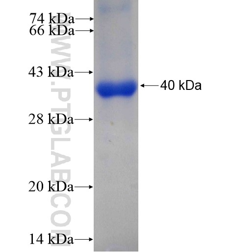 AGBL3 fusion protein Ag11013 SDS-PAGE AGBL3 fusion protein Ag11013 SDS-PAGE