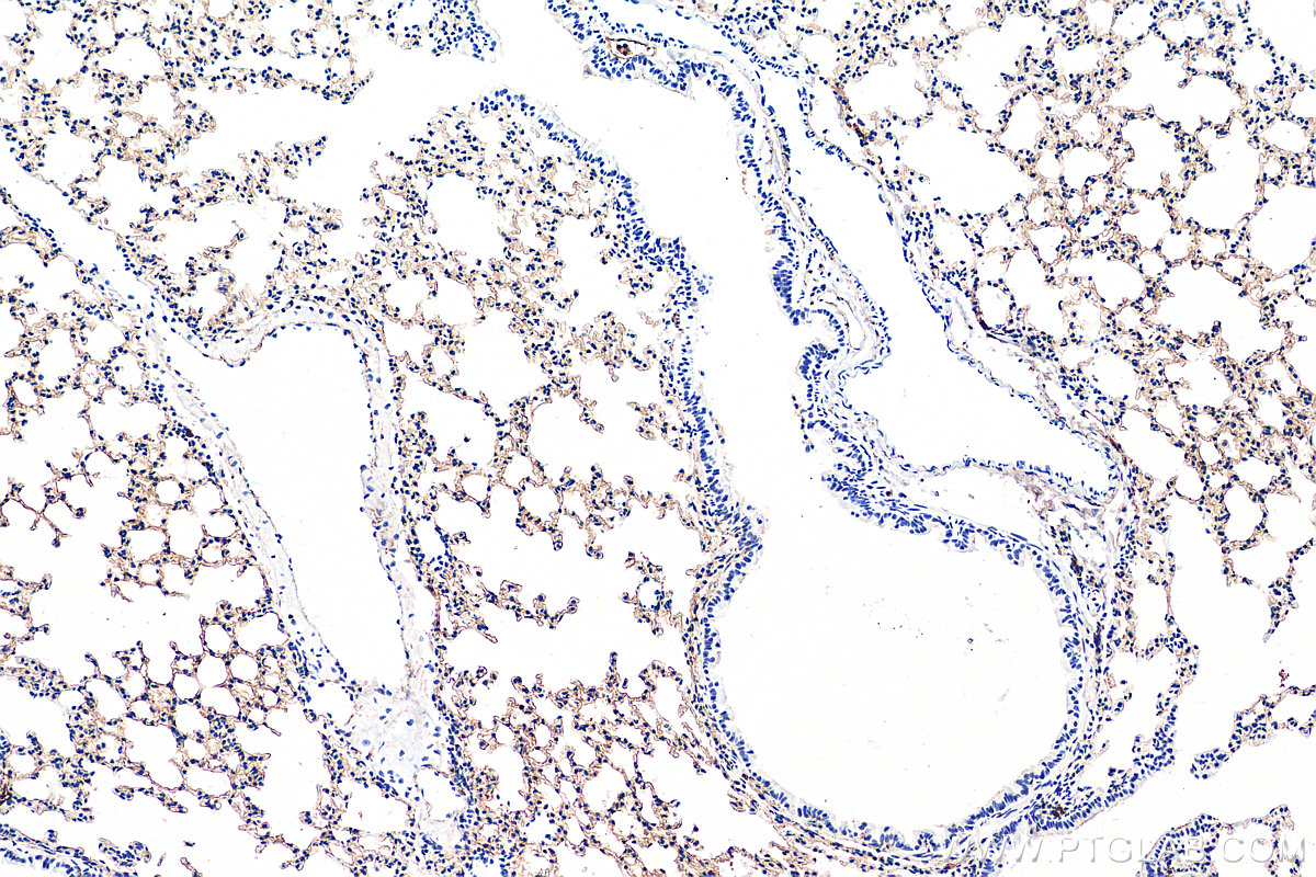 IHC staining of mouse lung using 16346-1-AP