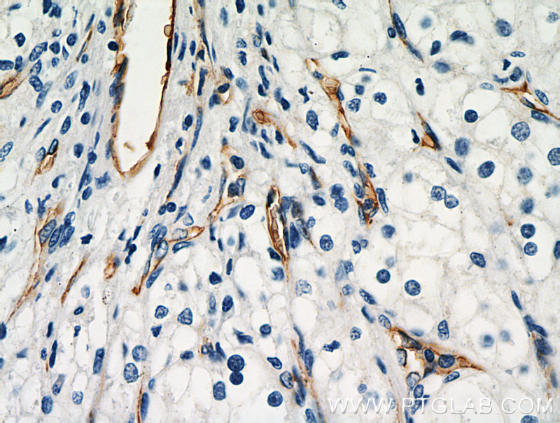 AGER Polyclonal antibody