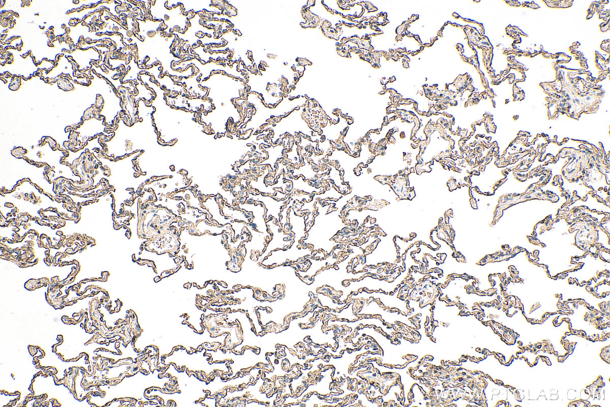 IHC staining of human lung using 66833-1-Ig (same clone as 66833-1-PBS)
