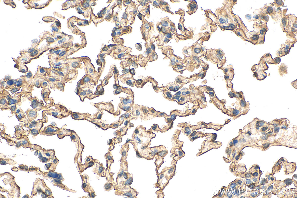 IHC staining of human lung using 66833-1-Ig (same clone as 66833-1-PBS)