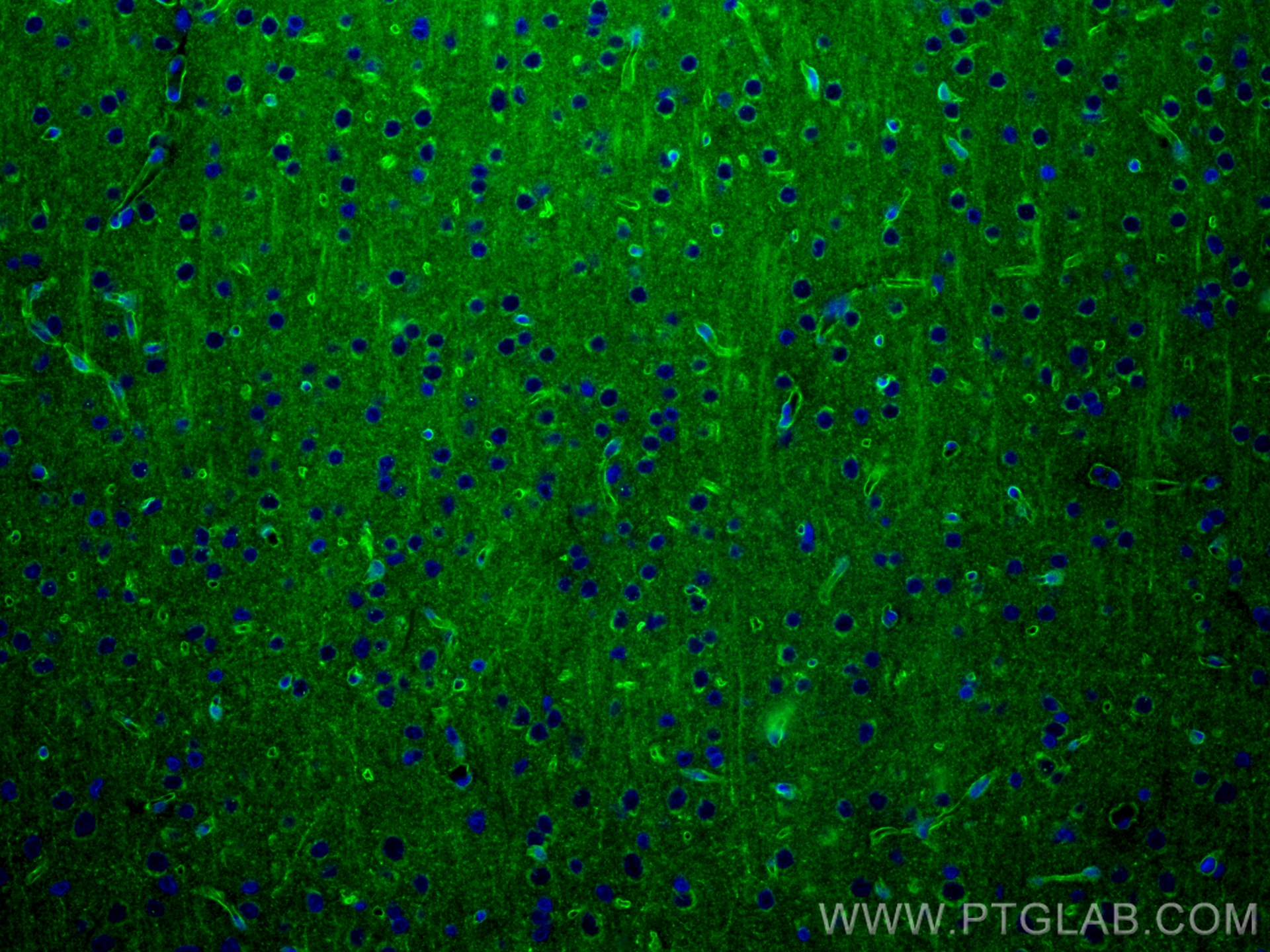 IF Staining of rat brain using 83759-4-RR