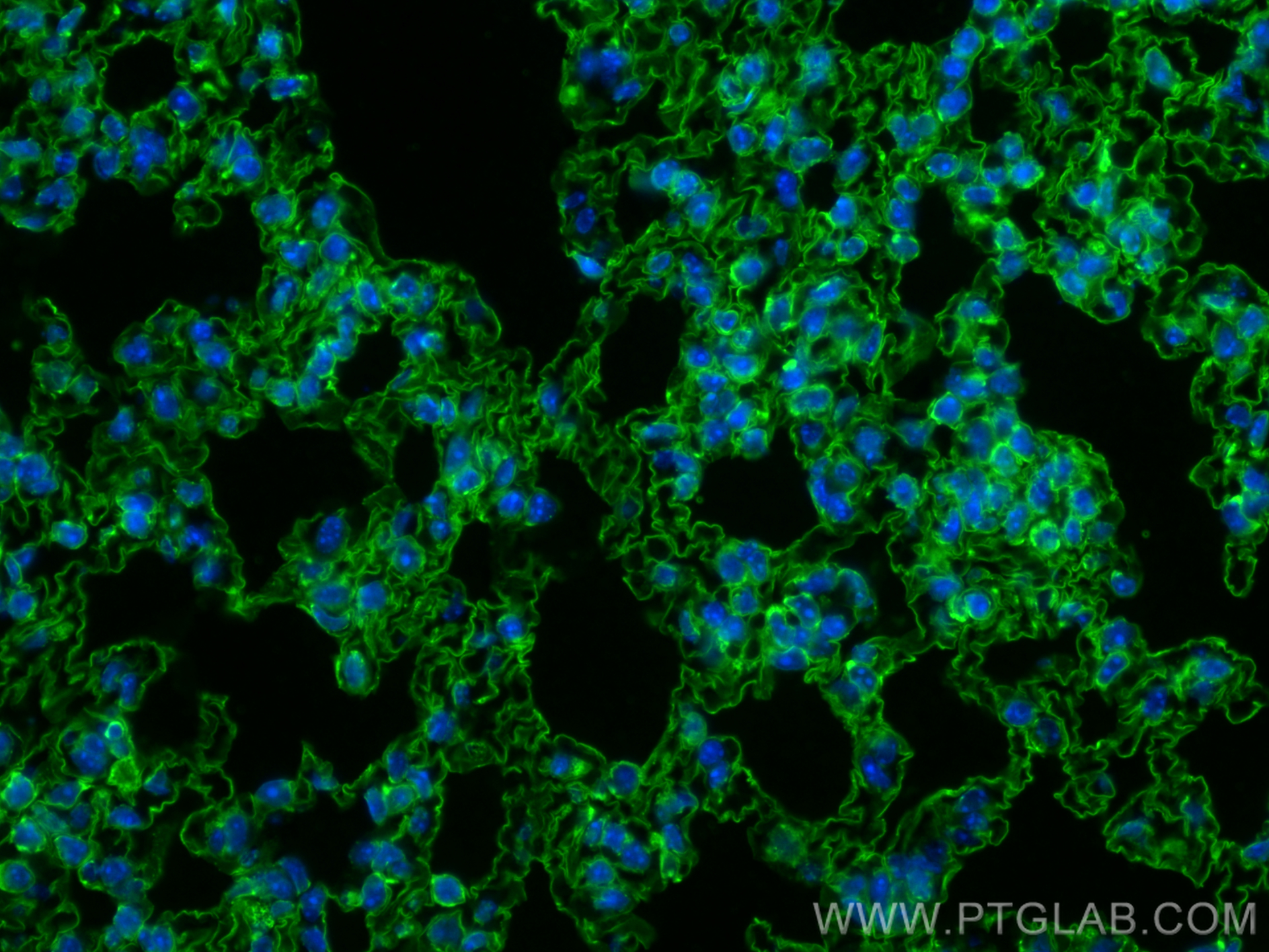 IF Staining of mouse lung using CL488-66833