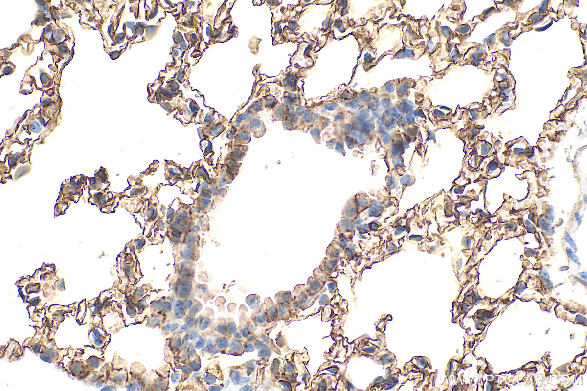 IHC staining of mouse lung using 32053-1-AP